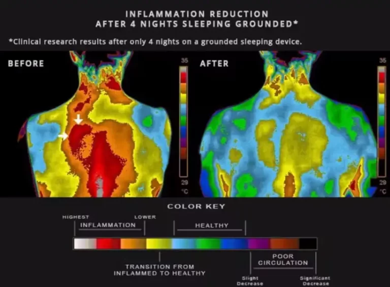 La inflamación como lenguaje: lo que tu cuerpo intenta decirte cuando enferma